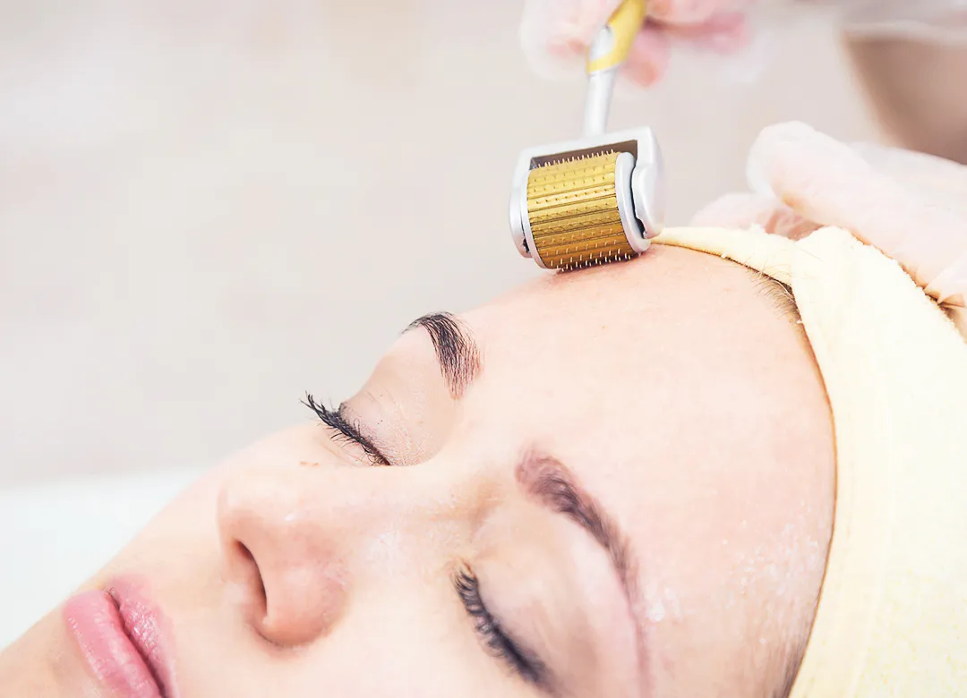 How Many Days After Microneedling Does Skin Peel, and When Does It Recover?