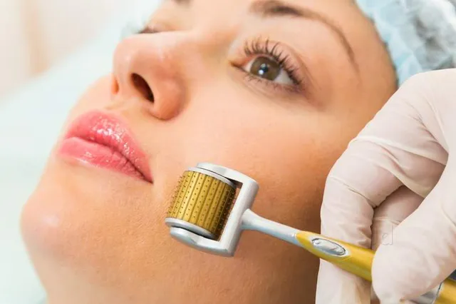 How Many Days After Microneedling Does Skin Peel, and When Does It Recover?