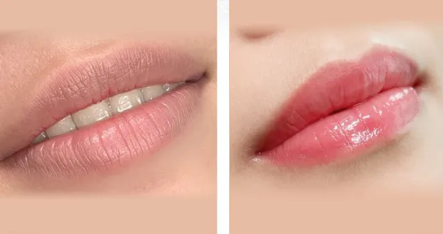 What Causes Dark Corners of the Mouth and How Can They Be Improved?