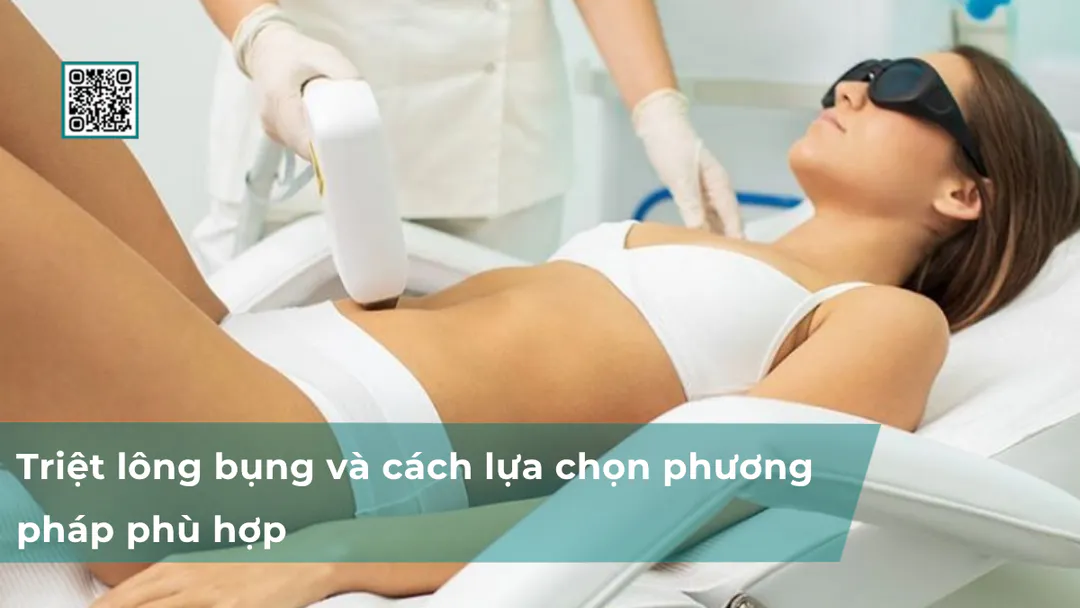 Triệt lông bụng và cách lựa chọn phương pháp phù hợp
