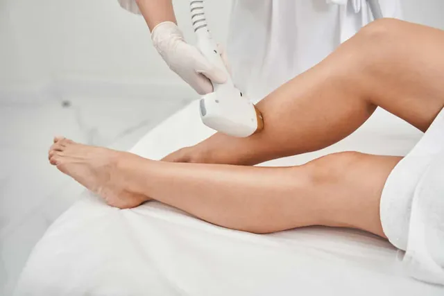 Triệt lông chân bằng laser và cách chuẩn bị cho liệu trình