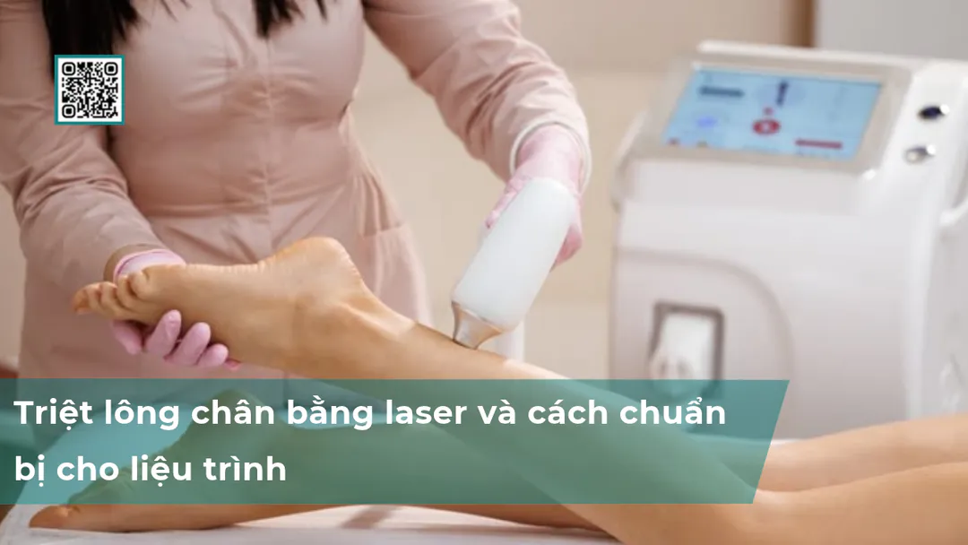 Triệt lông chân bằng laser và cách chuẩn bị cho liệu trình