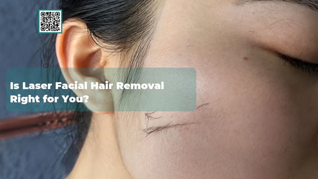 Is Laser Facial Hair Removal Right for You?