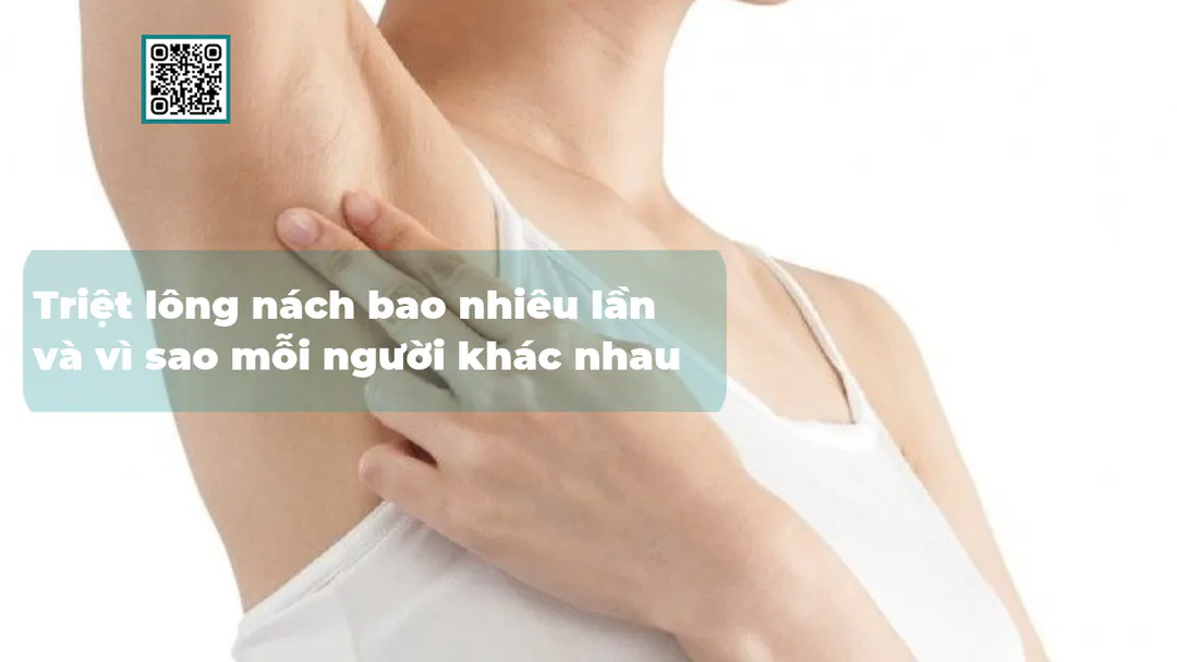 Triệt lông nách bao nhiêu lần và vì sao mỗi người khác nhau