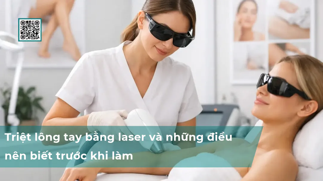 Triệt lông tay bằng laser và những điều nên biết trước khi làm