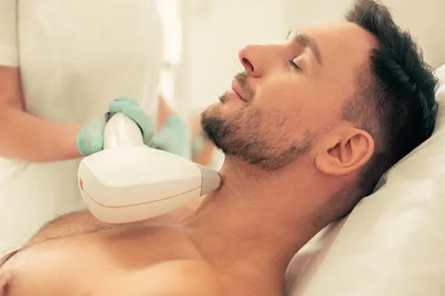 Beard hair removal for men