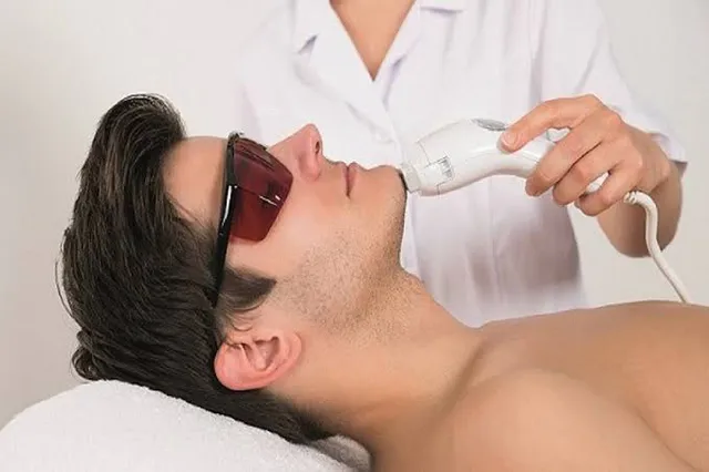 Triệt râu nam phù hợp với ai và cần cân nhắc điều gì