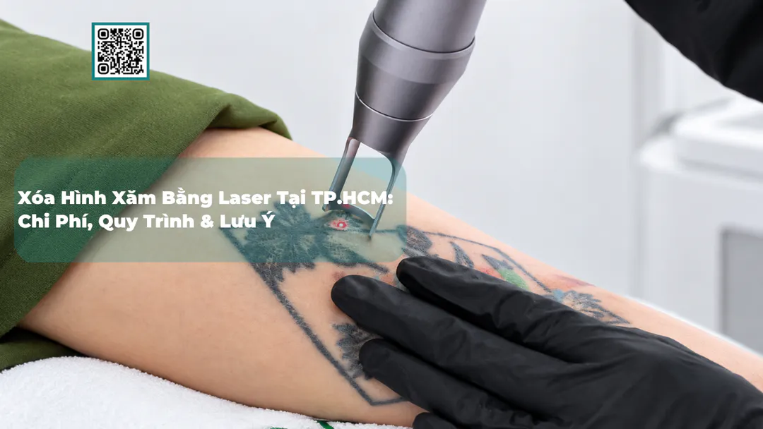 Xóa Hình Xăm Bằng Laser Tại TP.HCM